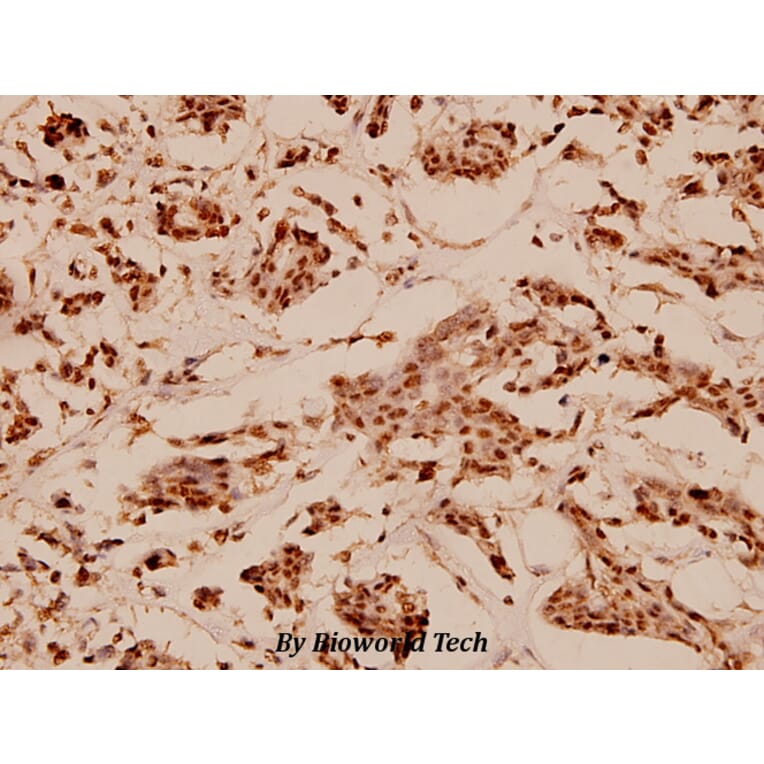Anti-N-CoR (H76) Antibody from Bioworld Technology (BS1462) - Antibodies.com