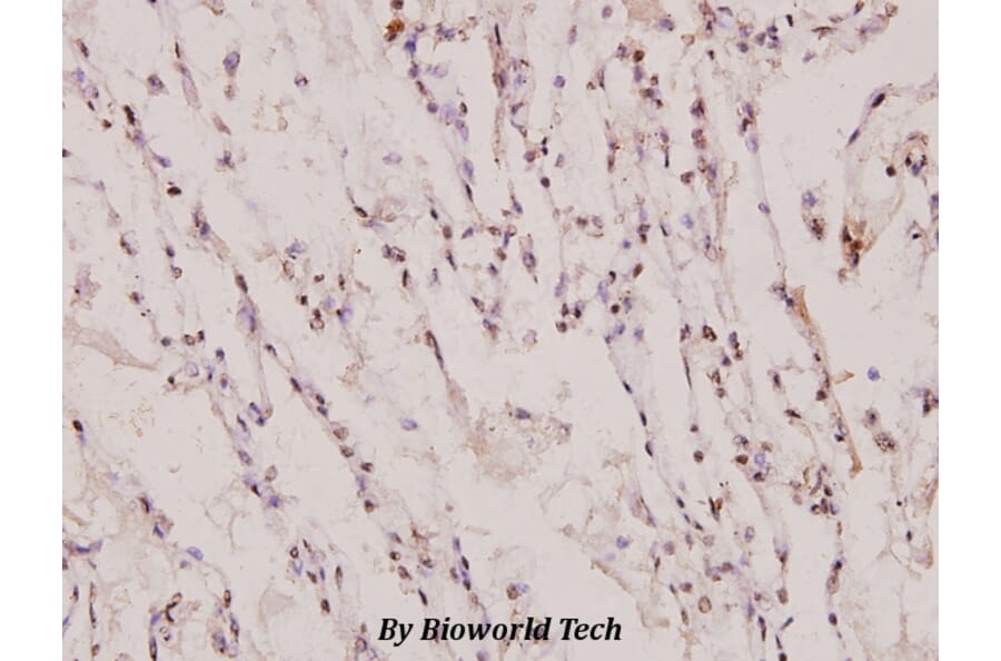 Anti-PIAS 1 (G24) Antibody from Bioworld Technology (BS1465) - Antibodies.com