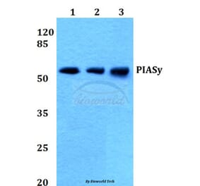 Anti-PIASy (D488) Antibody from Bioworld Technology (BS1468) - Antibodies.com