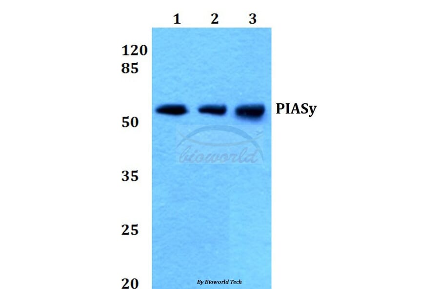 Anti-PIASy (D488) Antibody from Bioworld Technology (BS1468) - Antibodies.com