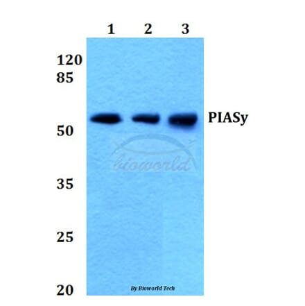 Anti-PIASy (D488) Antibody from Bioworld Technology (BS1468) - Antibodies.com