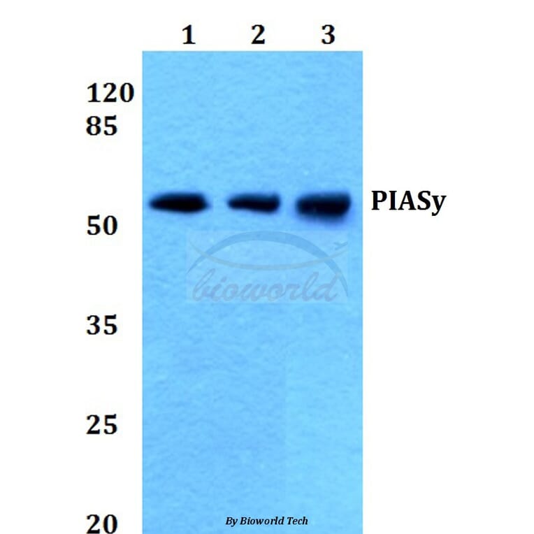 Anti-PIASy (D488) Antibody from Bioworld Technology (BS1468) - Antibodies.com