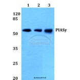 Anti-PIASy (D488) Antibody from Bioworld Technology (BS1468) - Antibodies.com