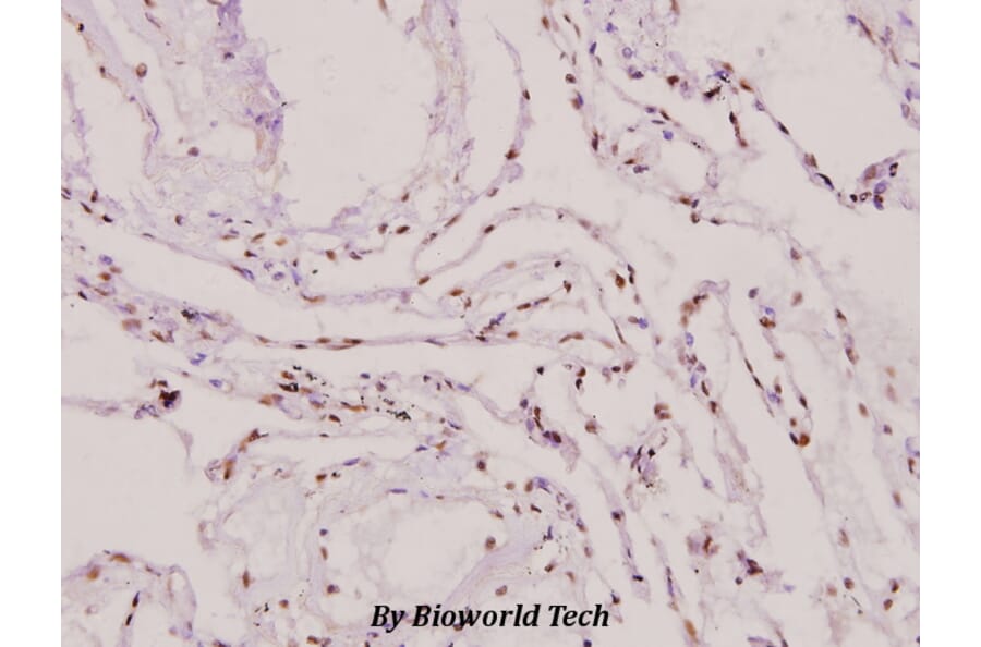 Anti-PIASy (D488) Antibody from Bioworld Technology (BS1468) - Antibodies.com