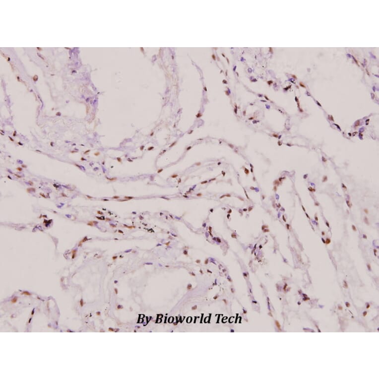 Anti-PIASy (D488) Antibody from Bioworld Technology (BS1468) - Antibodies.com