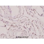 Anti-PIASy (D488) Antibody from Bioworld Technology (BS1468) - Antibodies.com