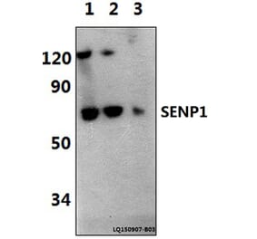 Anti-SENP1 (D2) Antibody from Bioworld Technology (BS1469) - Antibodies.com