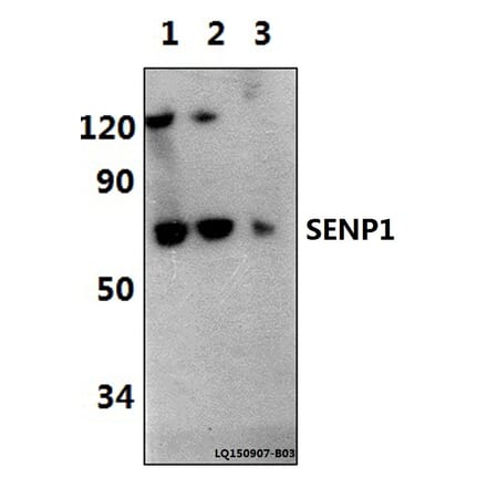Anti-SENP1 (D2) Antibody from Bioworld Technology (BS1469) - Antibodies.com