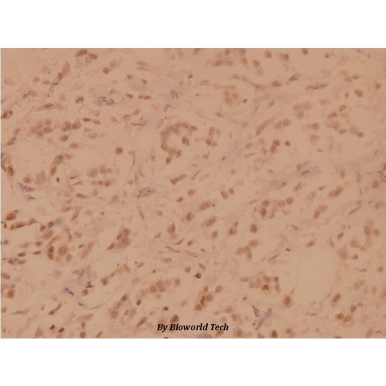 Anti-SENP3 (Y24) Antibody from Bioworld Technology (BS1471) - Antibodies.com