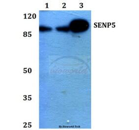 Anti-SENP5 (L681) Antibody from Bioworld Technology (BS1472) - Antibodies.com