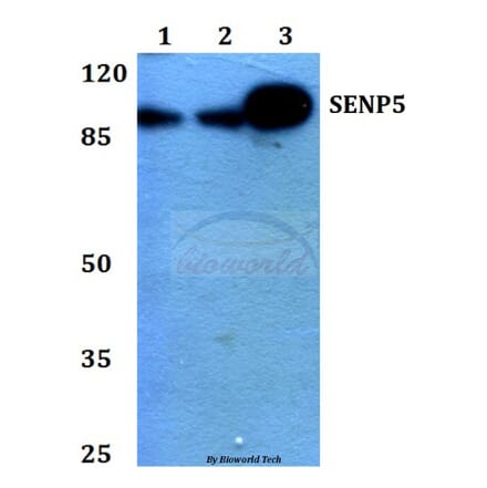 Anti-SENP5 (L681) Antibody from Bioworld Technology (BS1472) - Antibodies.com