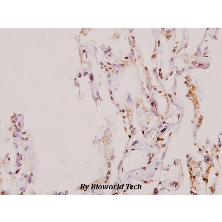 Anti-SENP5 (L681) Antibody from Bioworld Technology (BS1472) - Antibodies.com