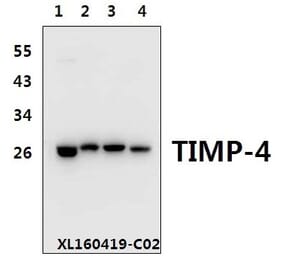 Anti-TIMP-4 (S206) Antibody from Bioworld Technology (BS1477) - Antibodies.com