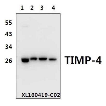 Anti-TIMP-4 (S206) Antibody from Bioworld Technology (BS1477) - Antibodies.com