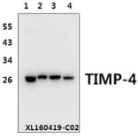 Anti-TIMP-4 (S206) Antibody from Bioworld Technology (BS1477) - Antibodies.com