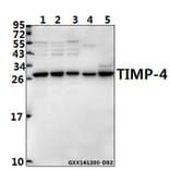 Anti-TIMP-4 (S206) Antibody from Bioworld Technology (BS1477) - Antibodies.com