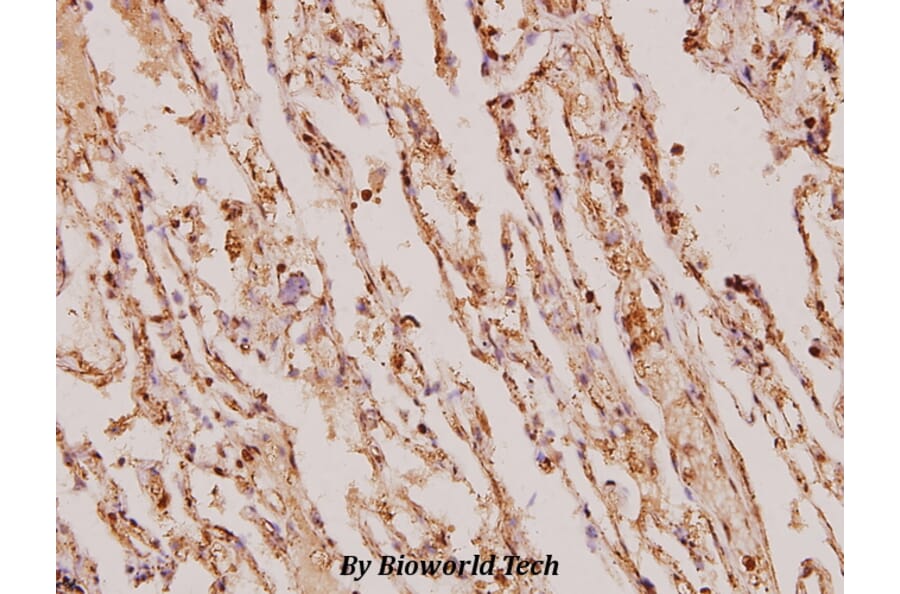 Anti-TIMP-4 (S206) Antibody from Bioworld Technology (BS1477) - Antibodies.com