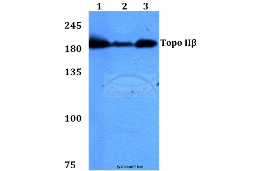 Anti-Topo IIβ (A32) Antibody from Bioworld Technology (BS1479) - Antibodies.com