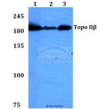 Anti-Topo IIβ (A32) Antibody from Bioworld Technology (BS1479) - Antibodies.com