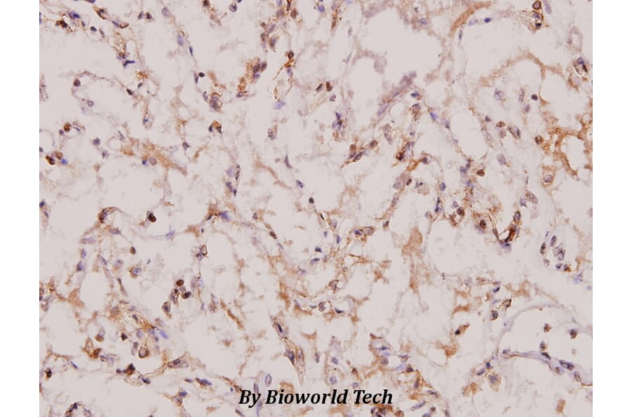 Anti-Topo IIβ (A32) Antibody from Bioworld Technology (BS1479) - Antibodies.com
