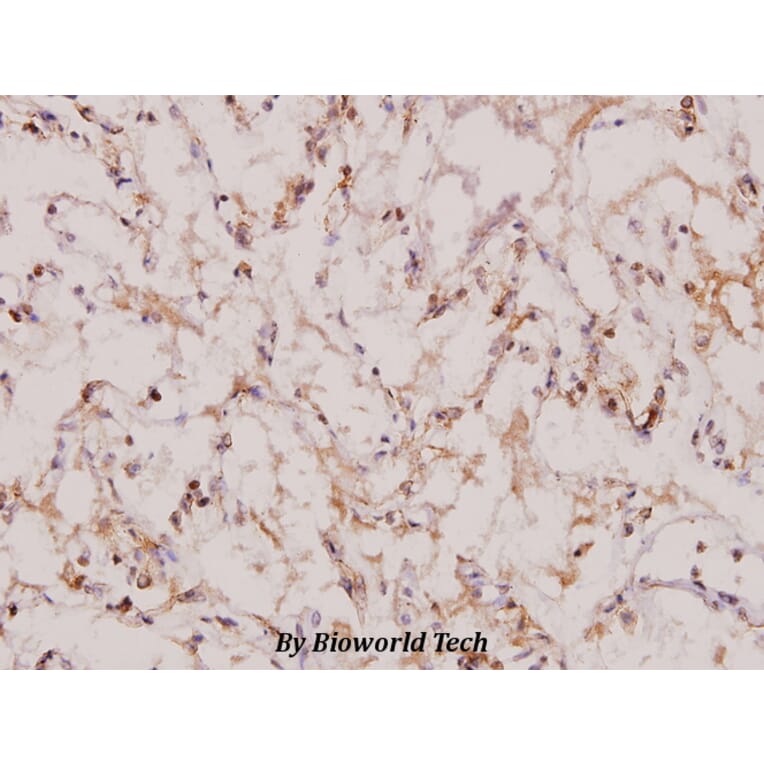 Anti-Topo IIβ (A32) Antibody from Bioworld Technology (BS1479) - Antibodies.com