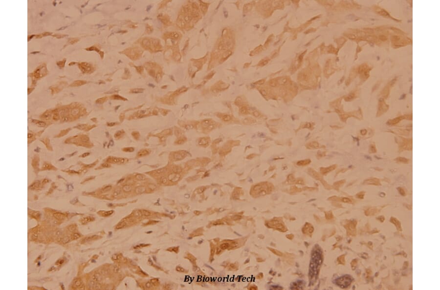 Anti-TRADD (L282) Antibody from Bioworld Technology (BS1480) - Antibodies.com