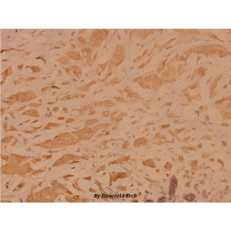 Anti-TRADD (L282) Antibody from Bioworld Technology (BS1480) - Antibodies.com