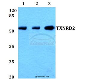 Anti-TXNRD2 (S501) Antibody from Bioworld Technology (BS1481) - Antibodies.com