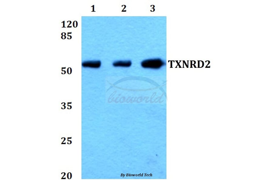 Anti-TXNRD2 (S501) Antibody from Bioworld Technology (BS1481) - Antibodies.com