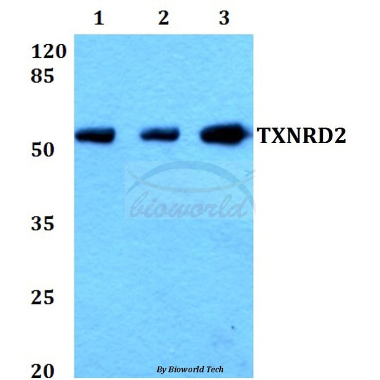 Anti-TXNRD2 (S501) Antibody from Bioworld Technology (BS1481) - Antibodies.com
