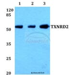 Anti-TXNRD2 (S501) Antibody from Bioworld Technology (BS1481) - Antibodies.com