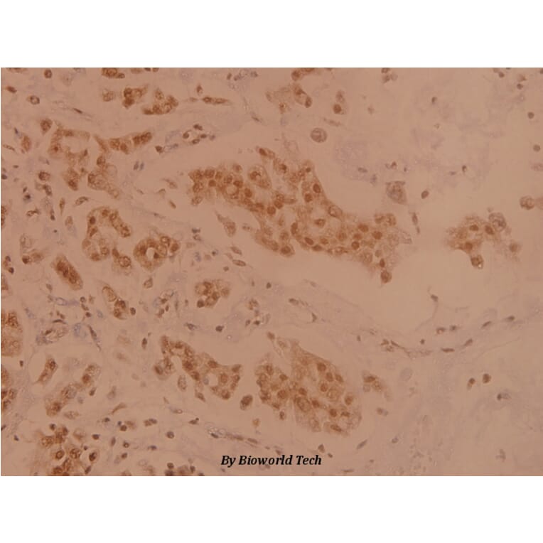 Anti-TXNRD2 (S501) Antibody from Bioworld Technology (BS1481) - Antibodies.com