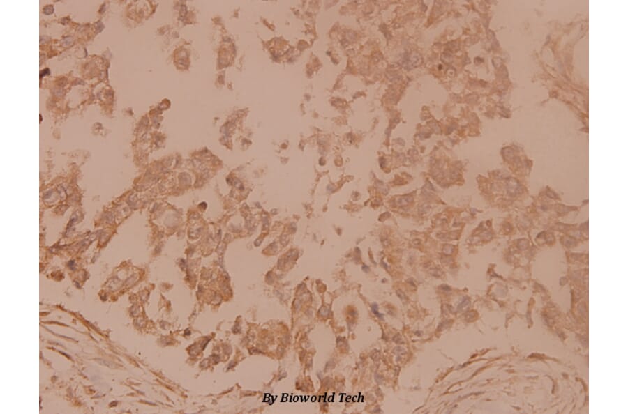 Anti-Tubulin γ (F414) Antibody from Bioworld Technology (BS1483) - Antibodies.com