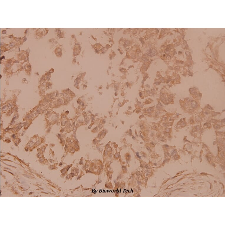 Anti-Tubulin γ (F414) Antibody from Bioworld Technology (BS1483) - Antibodies.com