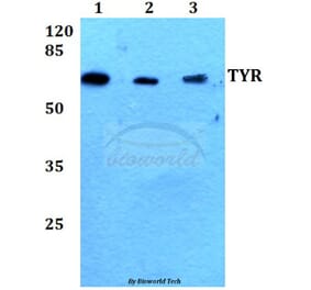Anti-TYR (R501) Antibody from Bioworld Technology (BS1484) - Antibodies.com