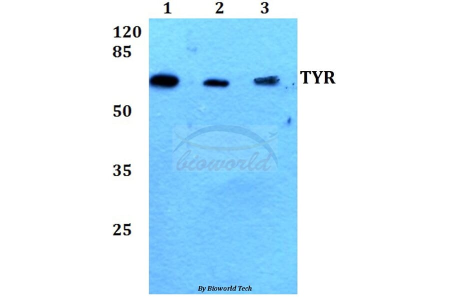 Anti-TYR (R501) Antibody from Bioworld Technology (BS1484) - Antibodies.com