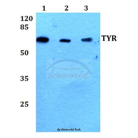 Anti-TYR (R501) Antibody from Bioworld Technology (BS1484) - Antibodies.com