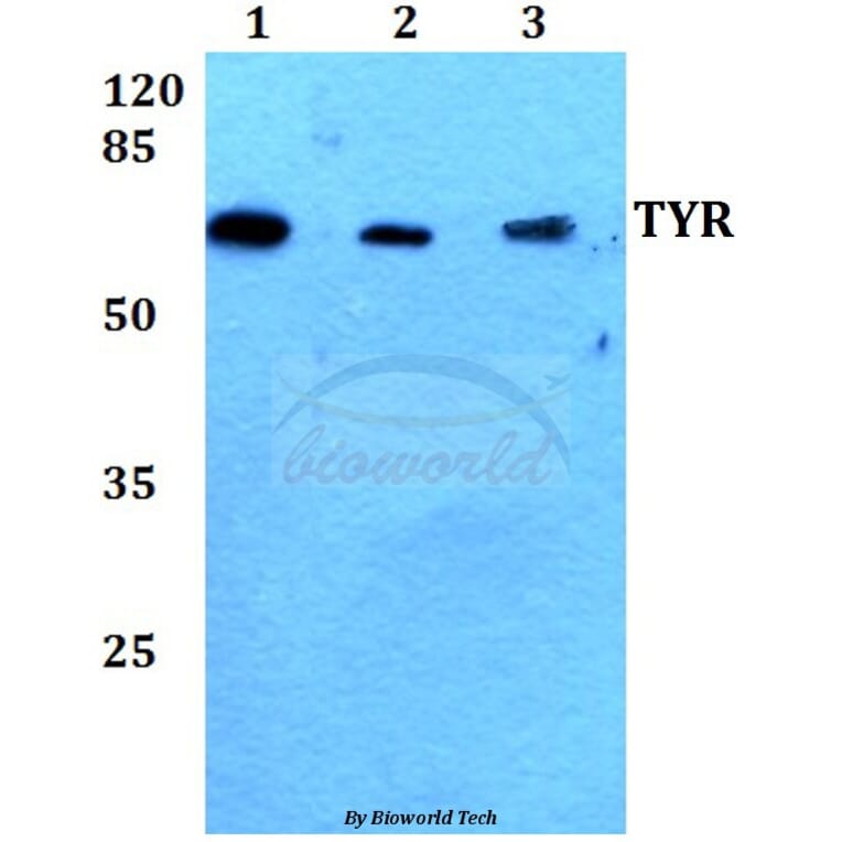 Anti-TYR (R501) Antibody from Bioworld Technology (BS1484) - Antibodies.com