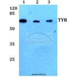 Anti-TYR (R501) Antibody from Bioworld Technology (BS1484) - Antibodies.com