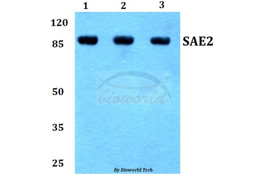 Anti-SAE2 (S621) Antibody from Bioworld Technology (BS1485) - Antibodies.com