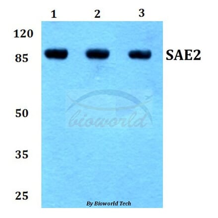 Anti-SAE2 (S621) Antibody from Bioworld Technology (BS1485) - Antibodies.com