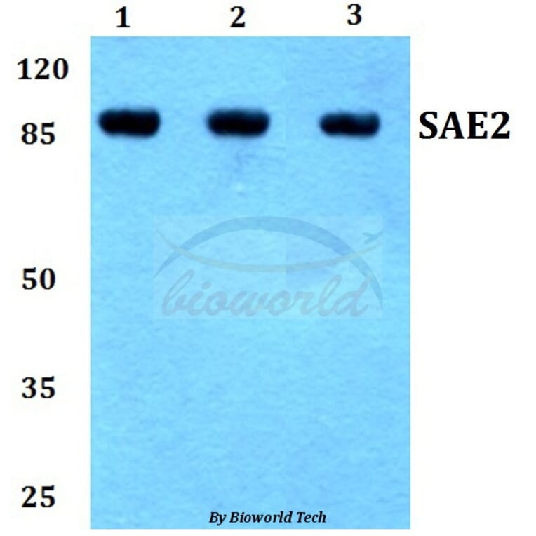 Anti-SAE2 (S621) Antibody from Bioworld Technology (BS1485) - Antibodies.com