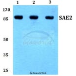 Anti-SAE2 (S621) Antibody from Bioworld Technology (BS1485) - Antibodies.com