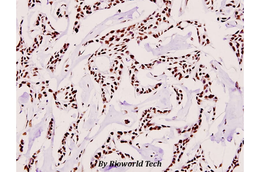 Anti-SAE2 (S621) Antibody from Bioworld Technology (BS1485) - Antibodies.com