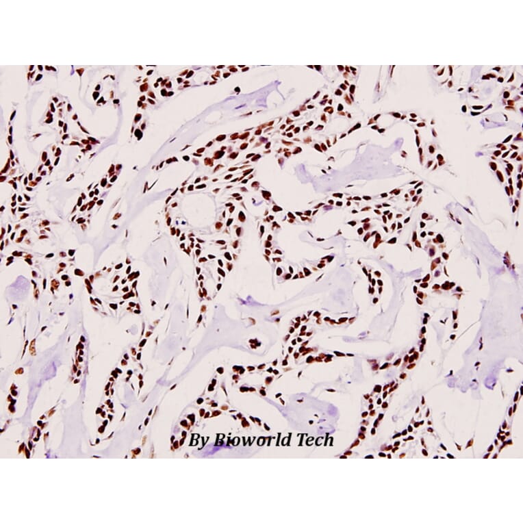Anti-SAE2 (S621) Antibody from Bioworld Technology (BS1485) - Antibodies.com
