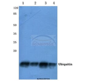 Anti-Ubiquitin (A46) Antibody from Bioworld Technology (BS1487) - Antibodies.com