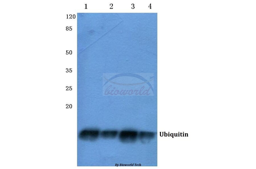 Anti-Ubiquitin (A46) Antibody from Bioworld Technology (BS1487) - Antibodies.com