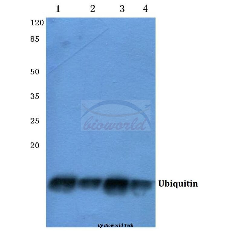 Anti-Ubiquitin (A46) Antibody from Bioworld Technology (BS1487) - Antibodies.com