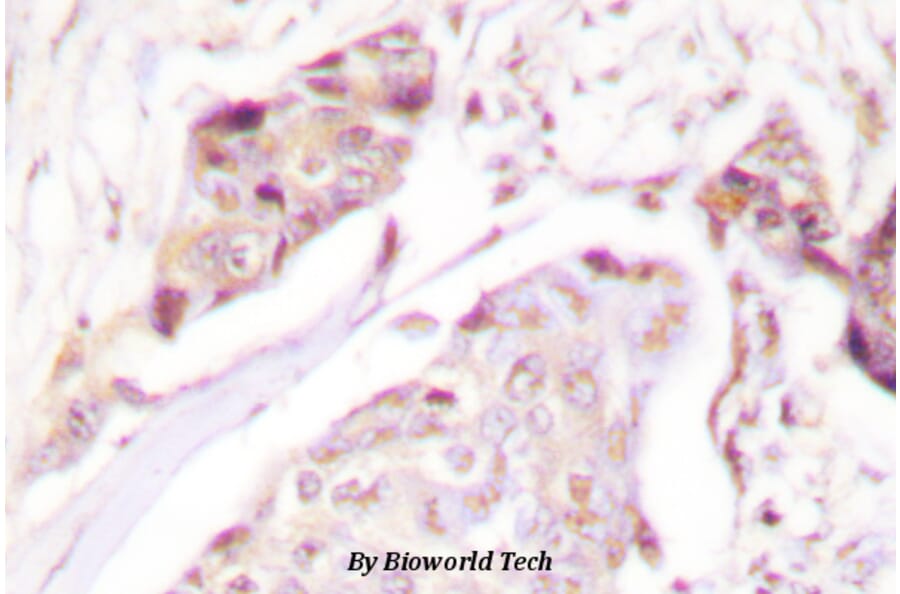 Anti-Ubiquitin (A46) Antibody from Bioworld Technology (BS1487) - Antibodies.com