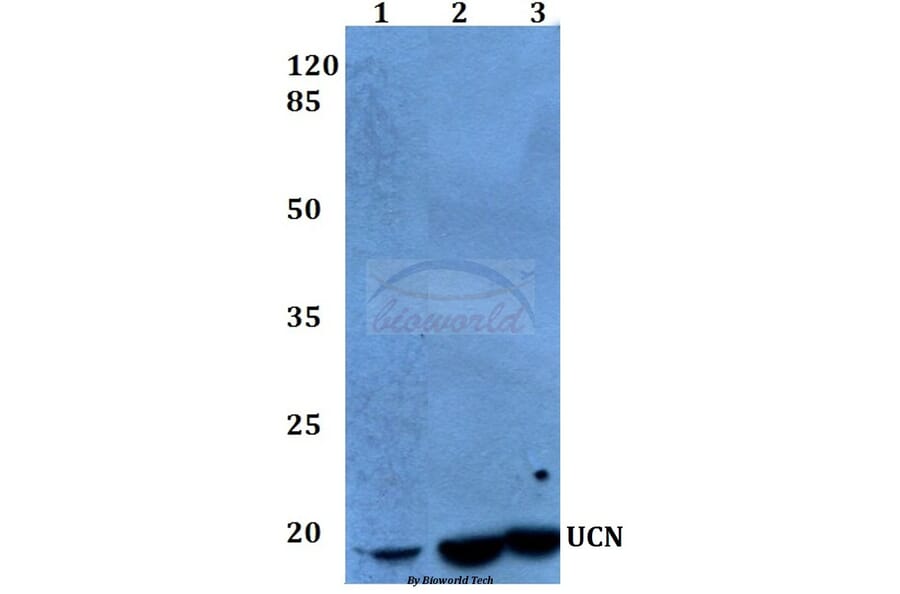 Anti-UCN (A103) Antibody from Bioworld Technology (BS1488) - Antibodies.com